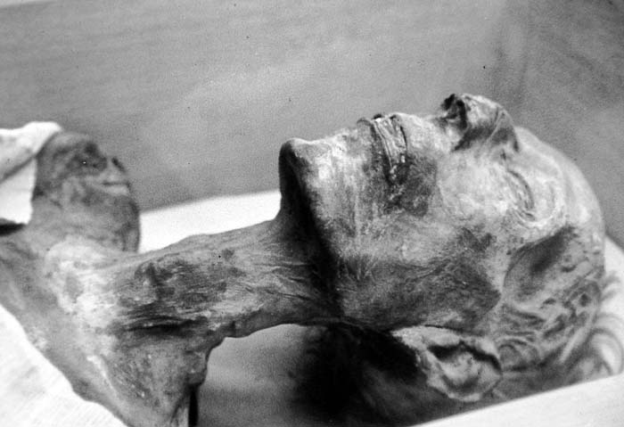 Ramses II mummy